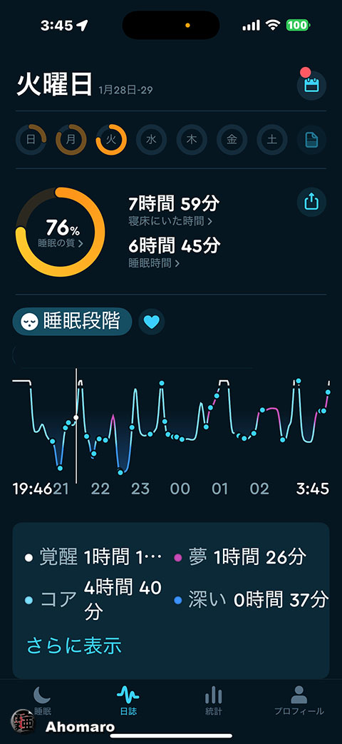 ʐ^00
