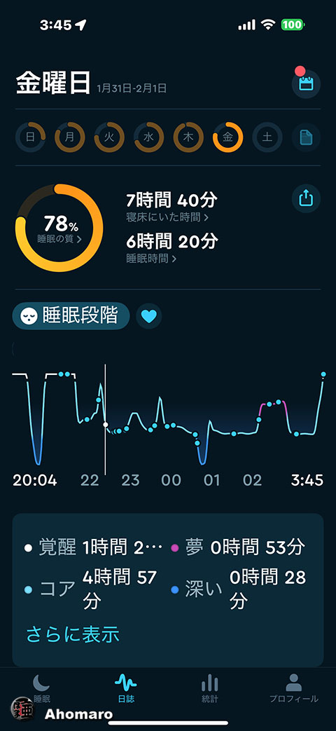 ʐ^00