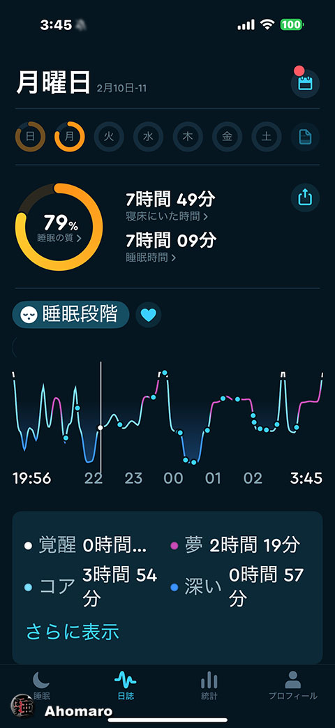 ʐ^00
