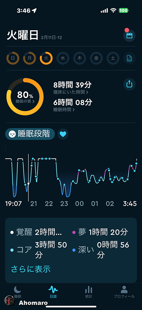ʐ^00