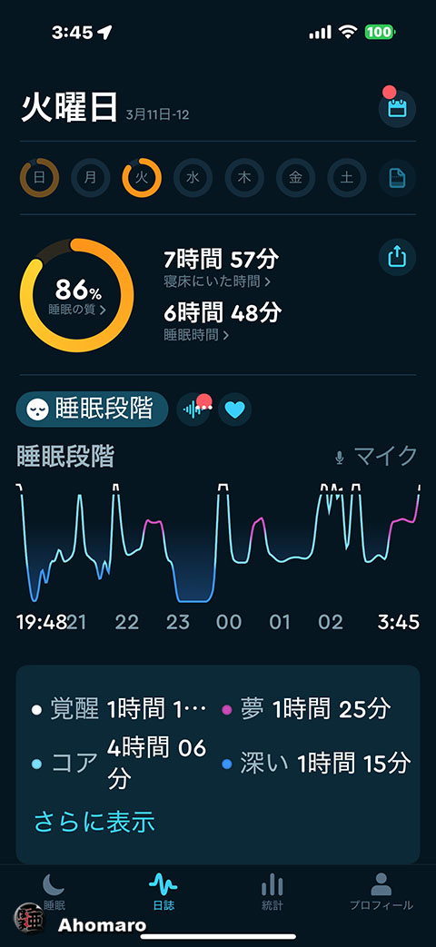 ʐ^00