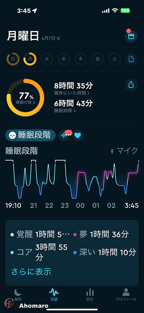 ʐ^00
