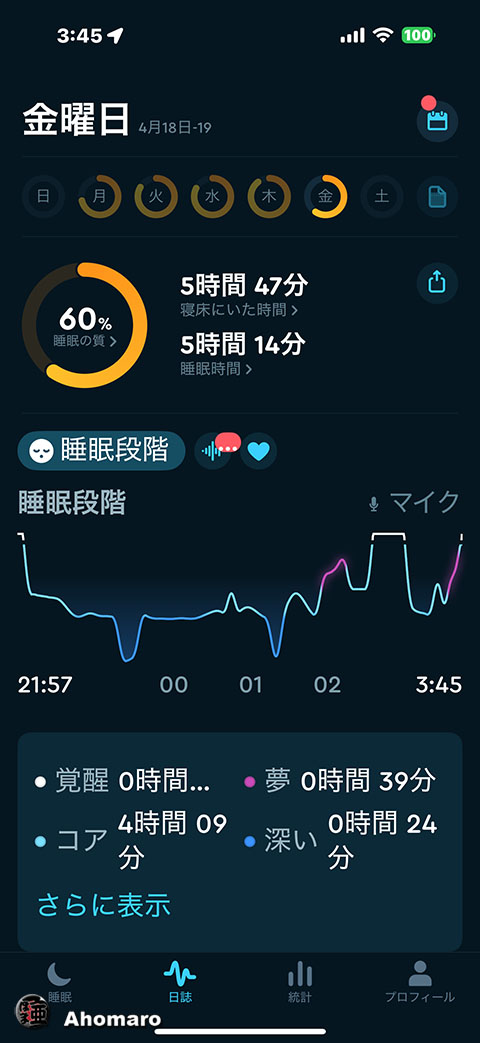 ʐ^00
