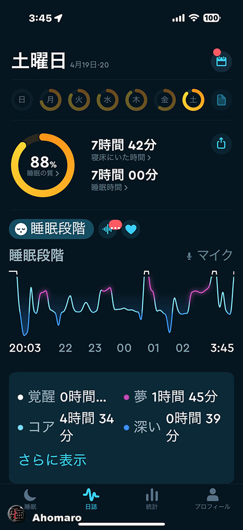 ʐ^00