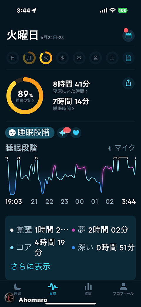 ʐ^00