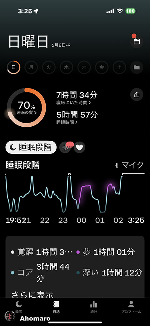 ʐ^00