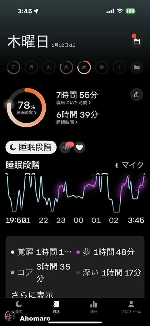 ʐ^00