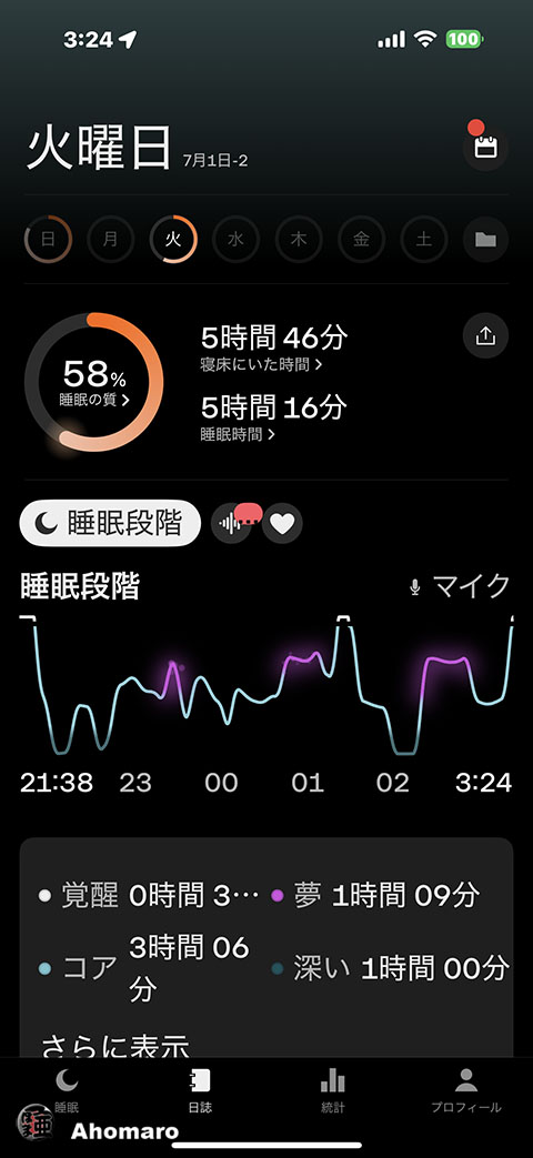 ʐ^00