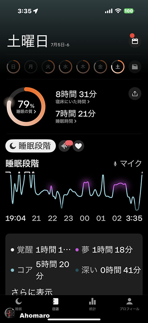 ʐ^00