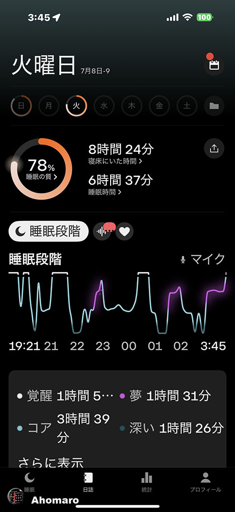 ʐ^00