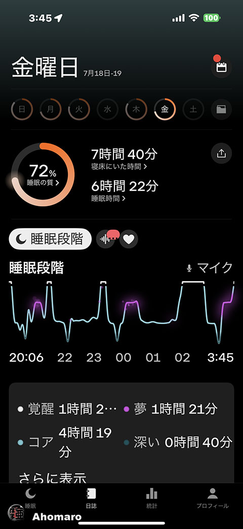 ʐ^00