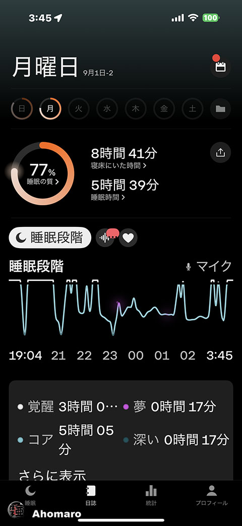 ʐ^00