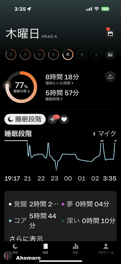 ʐ^00
