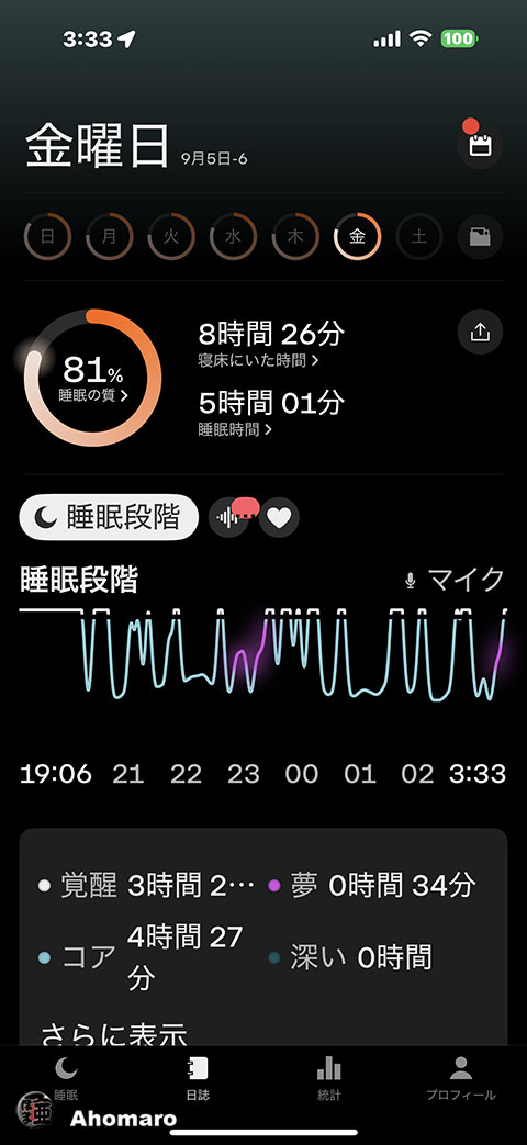 ʐ^00