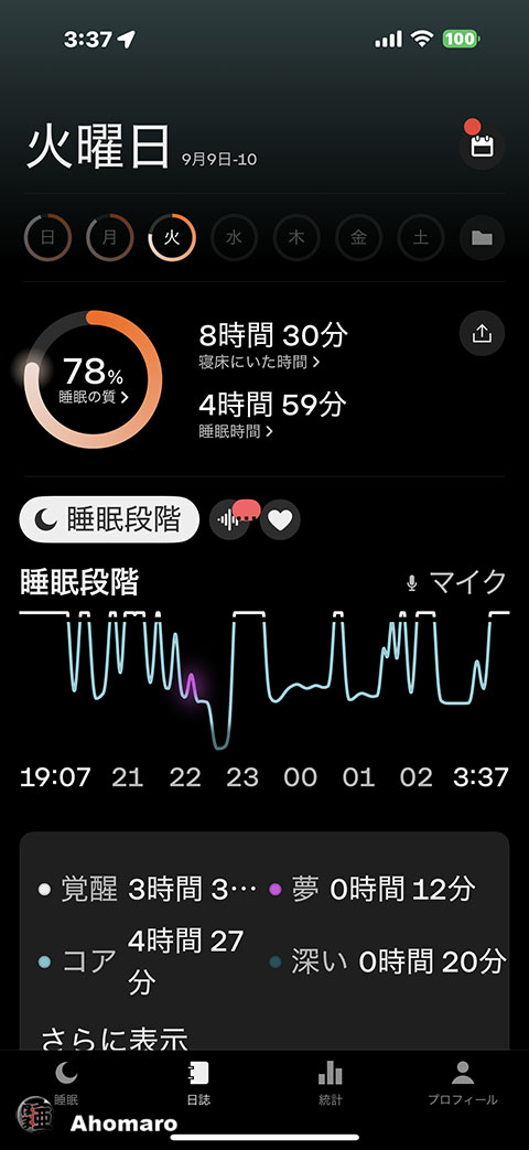ʐ^00